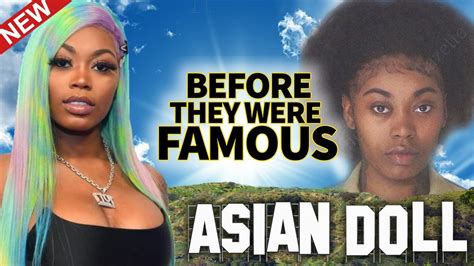 asian doll before surgery|More.